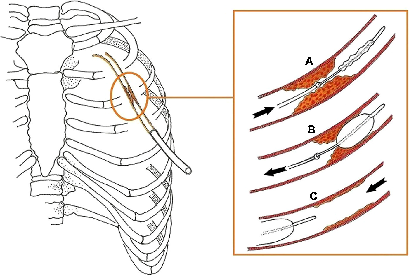 Image from Ref. 1, Boyacioglu et al.
